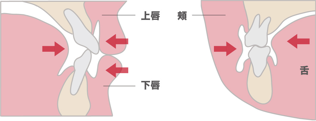 癖が歯並びに及ぼす影響は?